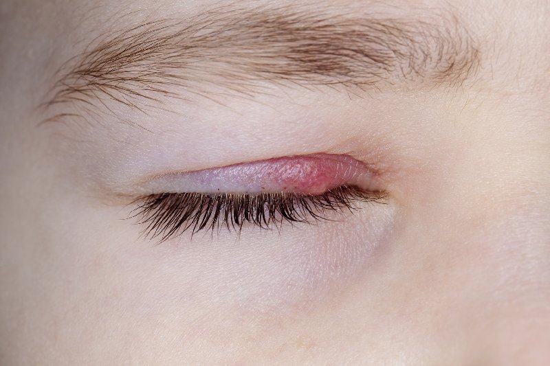 Co pomoże nam na jęczmień?